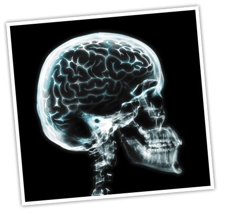 Human-body-brain.jpg