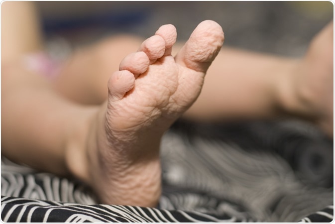www.news-medical.net