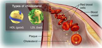 Image result for cholesterol meaning